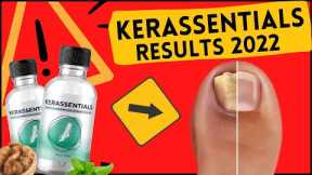 KERASSENTIALS REVIEW ⚠️( WARNING )⚠️ Nail Fungus Treatment Oil - KERASSENTIALS Honest Reviews 2022